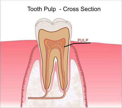 Tooth with Healthy Pulp Indicated